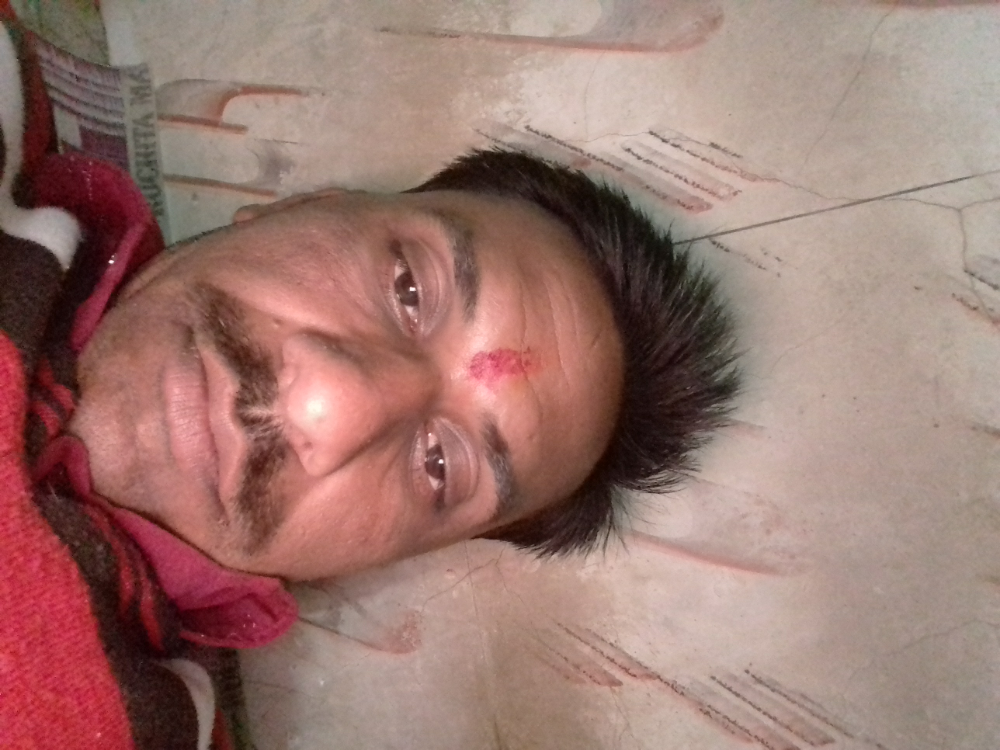 Hemant Mobile Gallery